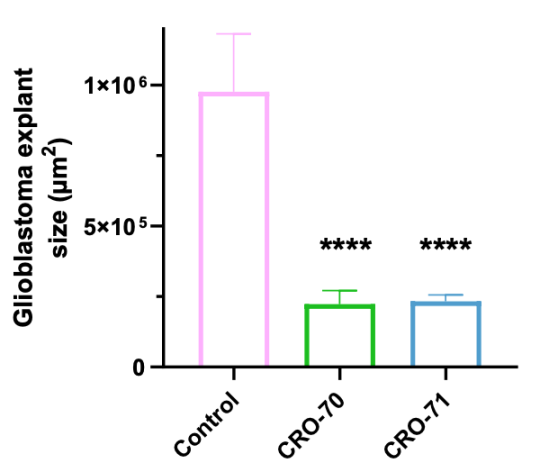 Noxopharm brain cancer drug candidates significantly reduce tumour growth